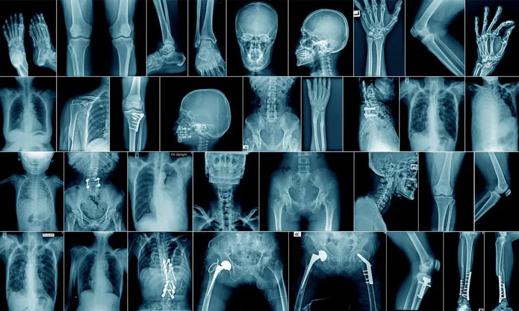Radiology